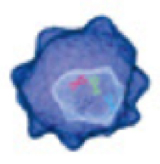 腫瘍細胞